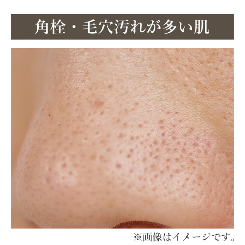 洗浄前