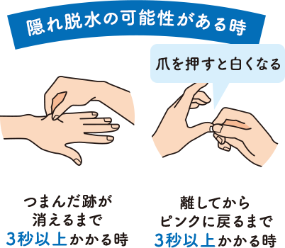 隠れ脱水の可能性がある時 つまんだ跡が消えるまで3秒以上かかる時 離してからピンクに戻るまで3秒以上かかる時